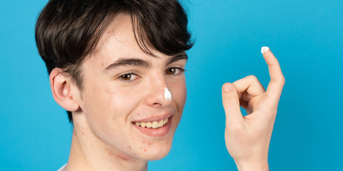 Teenager mit Akne, der Creme auf das Gesicht aufträgt