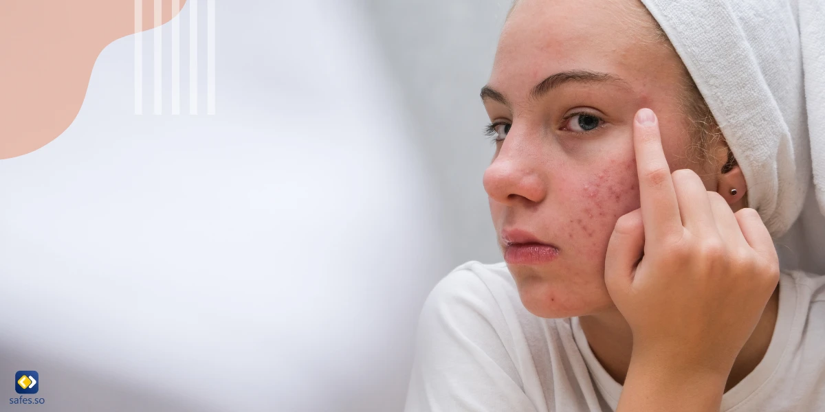 girl in front of a mirror with acne on her face and a towel on her head